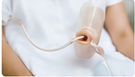 Feeding tube management at the bedside